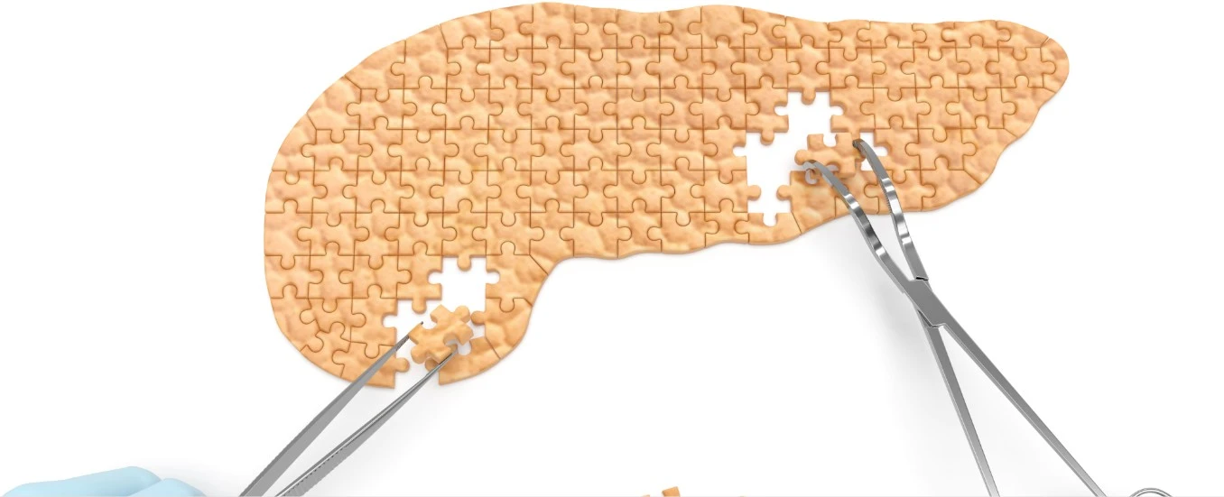 how pancreas removal affects digestion