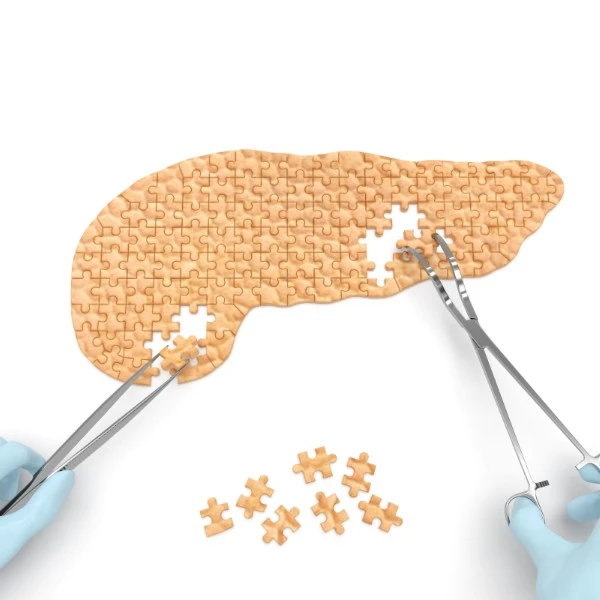 how pancreas removal affects digestion
